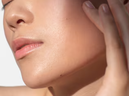 Gangnam Nasolabial Fold Lifting: How Effective Is It for Hollowing and Sagging? A Comparison of Thread Types 사진 4