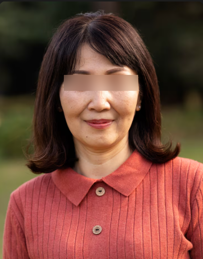 Gangnam Station Plastic Surgery: Considering a Forehead Lift? A Realistic Talk About Cost and Scars 사진 3