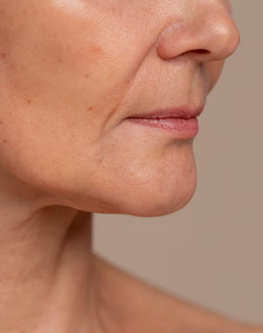 Gangnam Mint Thread Lift: Effects and Duration for Sagging Skin Needing a Clear Change 사진 6