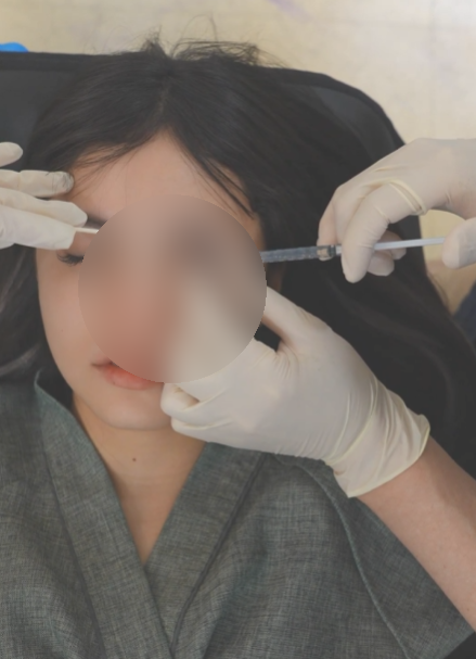 Gangnam Full Face Filler: How Does It Differ from Partial Fillers? Price, Pros & Cons, and Effects Explained by the Dire