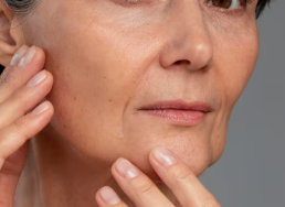 Deep Cheek Thread Lift with Mint Threads: When Does It Go Wrong? Design, Number of Threads, and Real Reviews 사진 2