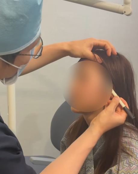 Apa yang harus diperhatikan saat memilih Rumah Sakit Face Lift di Seoul? Kriteria ulasan, harga, dan efek 사진 9