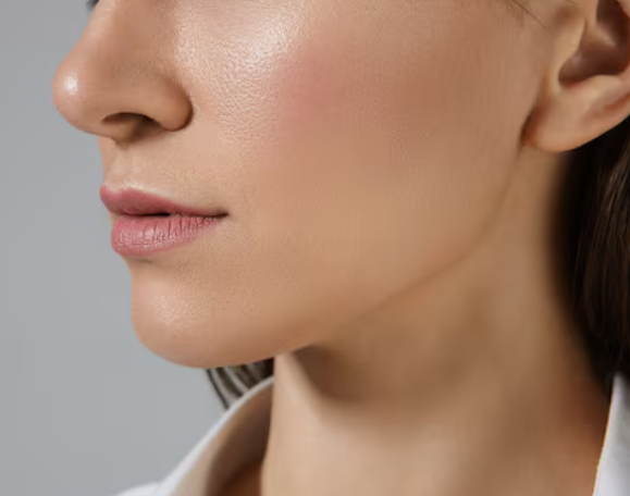 What are the effects of cheek filler? How to create a youthful face with petit plastic surgery and its side effects 사진 3