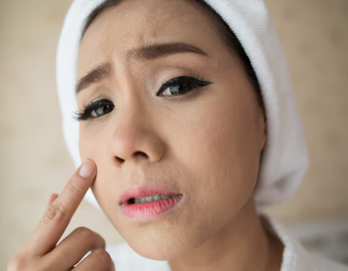 Is a Forehead Lift Too Early in Your 30s? The Director Explains Surgery Timing and Before-and-After Differences 사진 3