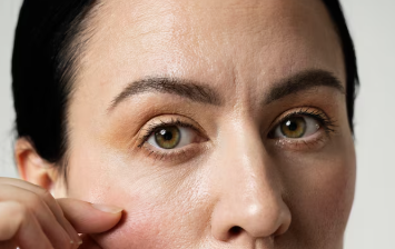 Is a Forehead Lift Too Early in Your 30s? The Director Explains Surgery Timing and Before-and-After Differences