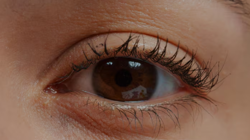 Criteria for Choosing a Good Mid-Life Eye Surgery Clinic: Differences Between Under-Eye Fat Repositioning and Ptosis Cor
