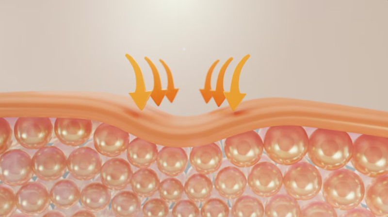 Mini Facelift: Duration, Side Effects, and Scarring – What You Need to Know