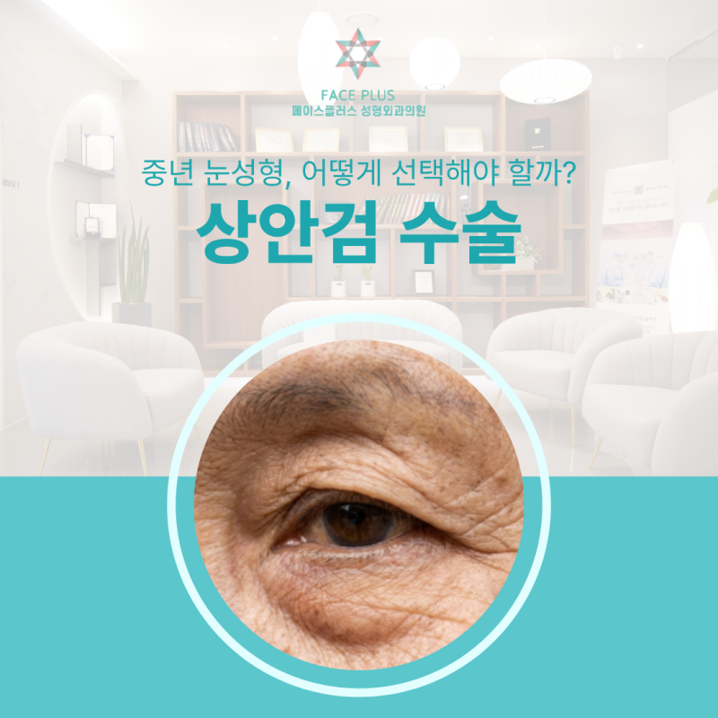 Upper Blepharoplasty Reviews: What Real Changes Can You Expect? Improving Droopy Eyelids and Essential Pre-Surgery Consi