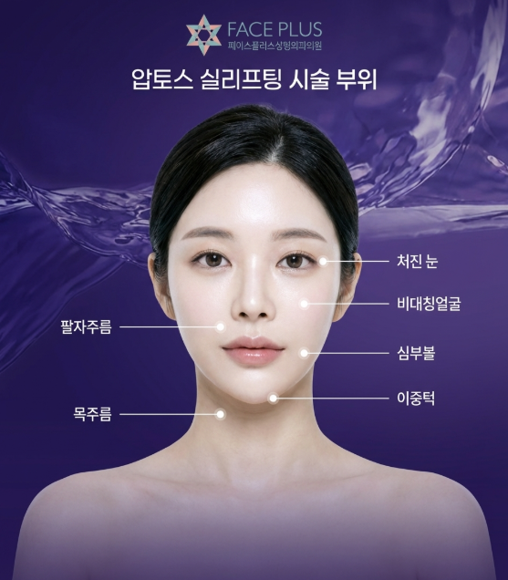 Aptos Thread Lift: Which Face Type Is It Best For? Selection Criteria Based on Sagging Type 사진 6