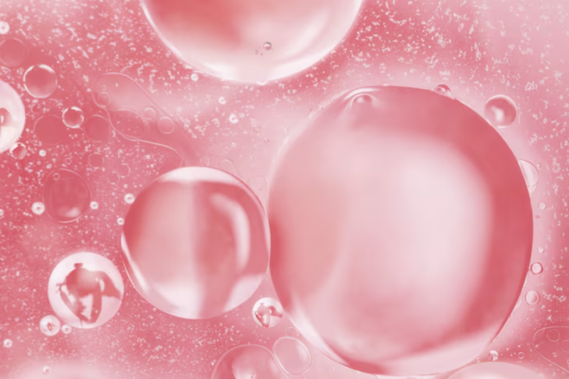 Mini-Ting Thread Lift: When Can It Help? Explaining the Lifting Effect for Sagging Faces 사진 10