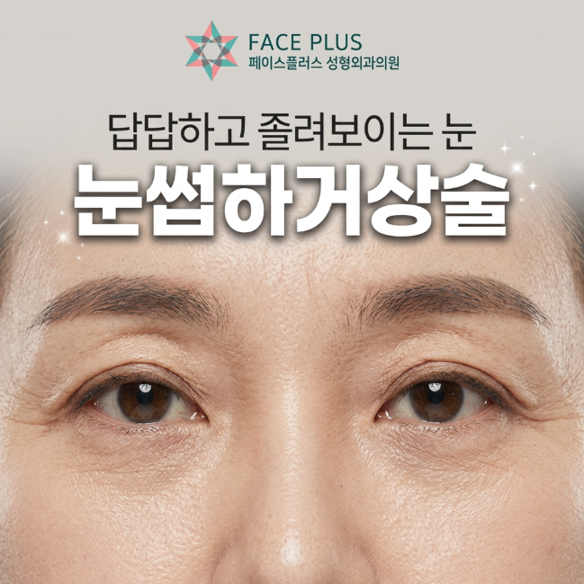 When is a Sub-Brow Lift Needed? The Difference Between Eyebrow Ptosis and Eyelid Ptosis, Explained by the Director 사진 9