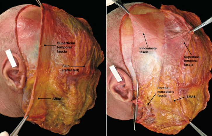 Is There a Difference with a Gangnam Plastic Surgeon Specialist? How to Verify a Specialist 사진 8