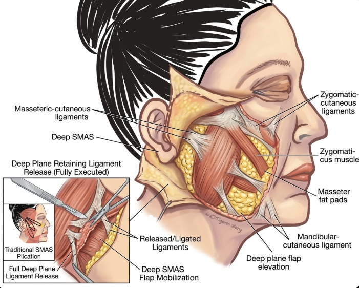 Apa Kriteria Memilih Rumah Sakit Terbaik untuk Facelift? Metode Operasi Facelift dan Poin Penting Konsultasi 사진 5