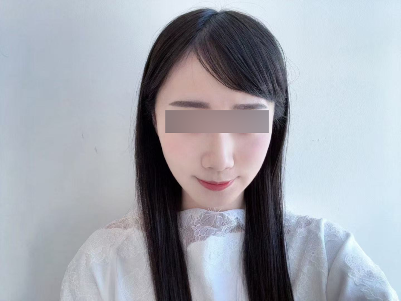 Preparing for the Wedding: Naturally Refining Your Look with Thread Lifts 사진 8