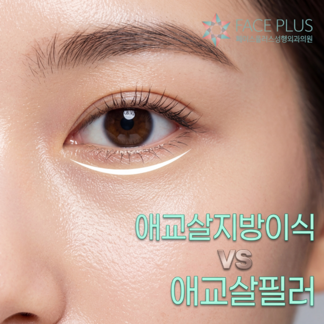 Aegyo-sal Fat Grafting vs. Aegyo-sal Filler: Which is More Natural? Duration and Side Effects Explained 사진 3