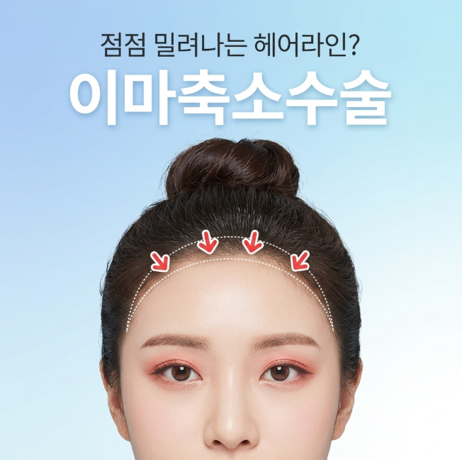 Where is the difference in a good forehead reduction surgery? Naturalness, Scars, Design Standards 사진 7