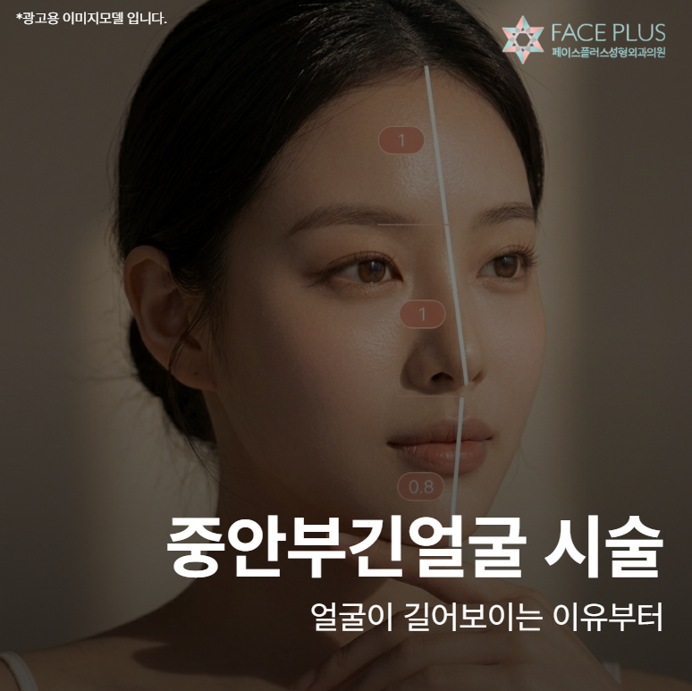 Midface Lengthening Treatment: Understanding Why Your Face Might Appear Longer