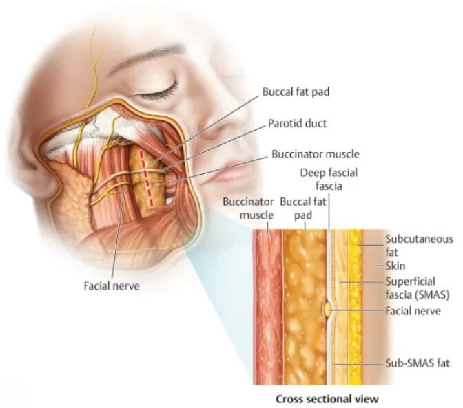 Facial Thread Lift Cost: ₩1 Million vs. ₩4 Million – The Real Reasons for the Difference 사진 6
