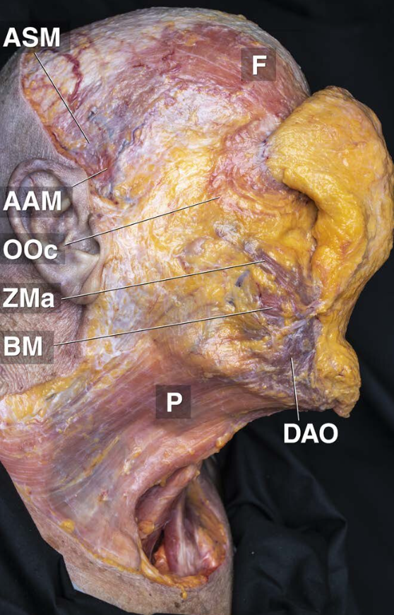 Hal-hal yang Perlu Diketahui Sebelum Operasi Facelift – Harga, Nyeri, dan Periode Pemulihan 사진 4