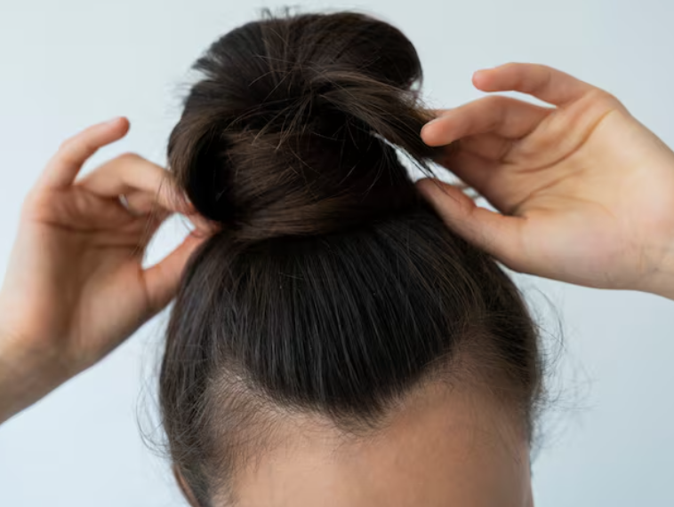 If you're worried about scars from forehead reduction surgery, check your hairline and recovery first. 사진 4
