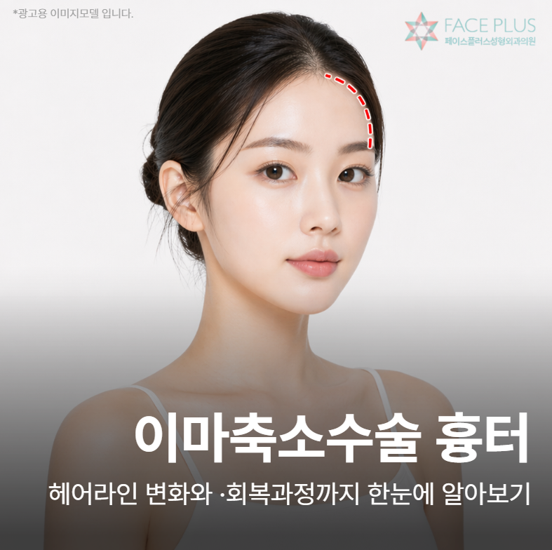 If you're worried about scars from forehead reduction surgery, check your hairline and recovery first.