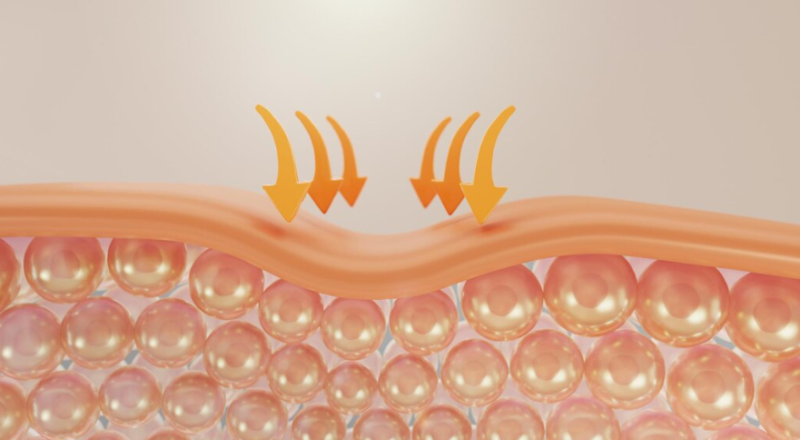 How Much Scarring Does a Mini Facelift Leave? – Realistic Overview of Swelling, Numbness, and Recovery Time 사진 4