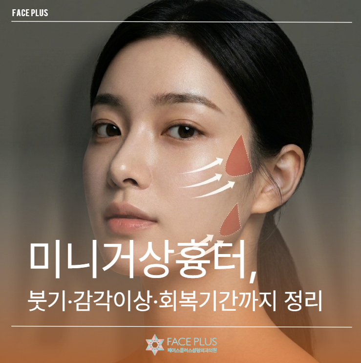 How Much Scarring Does a Mini Facelift Leave? – Realistic Overview of Swelling, Numbness, and Recovery Time