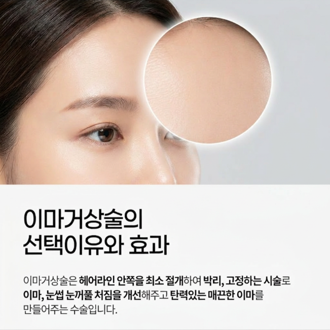 Why Karina's Forehead Lift Look Feels Different: Explaining Ptosis Improvement and Eye Shape Change 사진 3