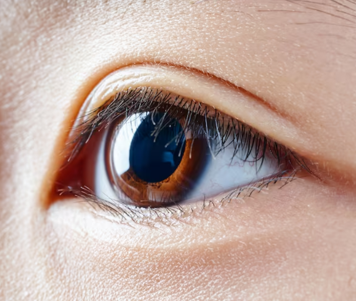Lower Blepharoplasty vs. Under-Eye Fat Repositioning: When Does the Choice Differ? 사진 10