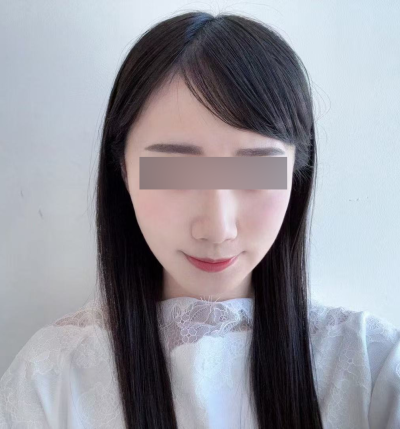 Perbedaan Mint Thread vs Silhouette Soft, Penjelasan Durasi, Efek, dan Jenis Benang 사진 8