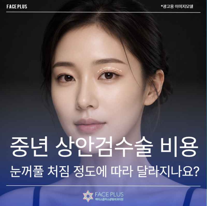 Middle-aged Upper Blepharoplasty Cost May Vary Depending on the Degree of Eyelid Sagging