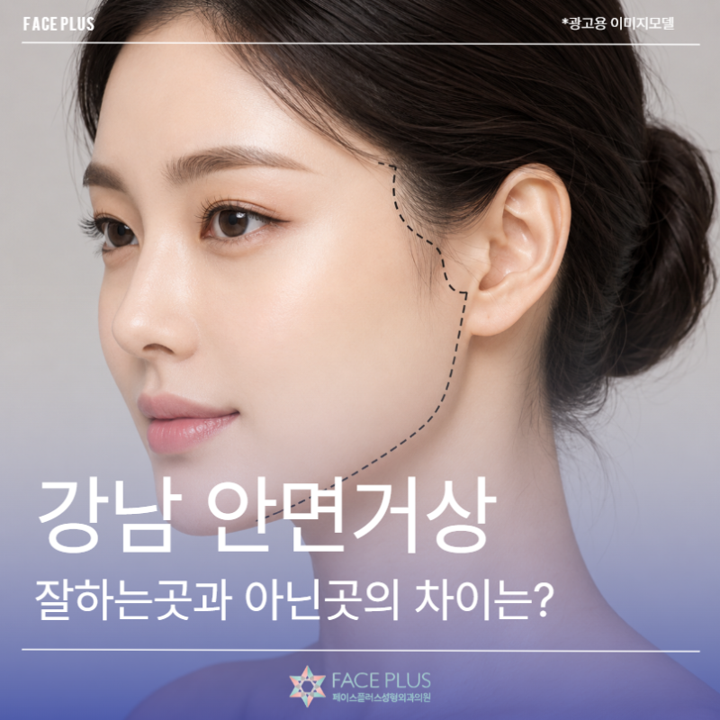 Gangnam Facelift Specialist: Explaining SMAS Layer Dissection and Lifting Range