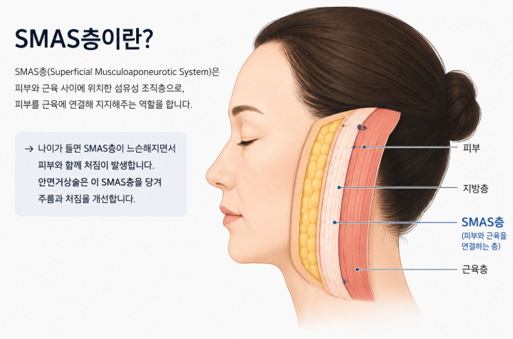 Gangnam Facelift Specialist: Explaining SMAS Layer Dissection and Lifting Range 사진 5