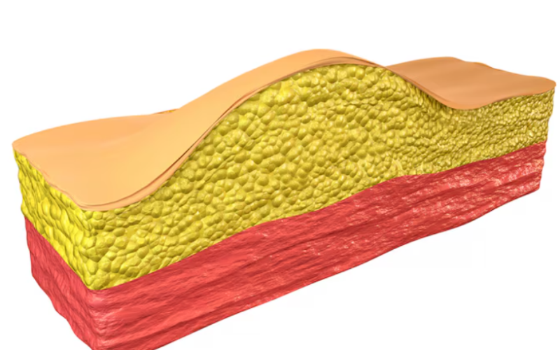 Why Ponytail Lifting Costs Vary Greatly: Impact of Incision Range and Lifting Method Explained