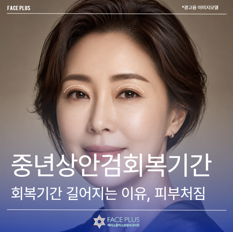 Reasons for Longer Recovery Period After Middle-Aged Upper Blepharoplasty: Impact of Skin Sagging and Eyelid Thickness