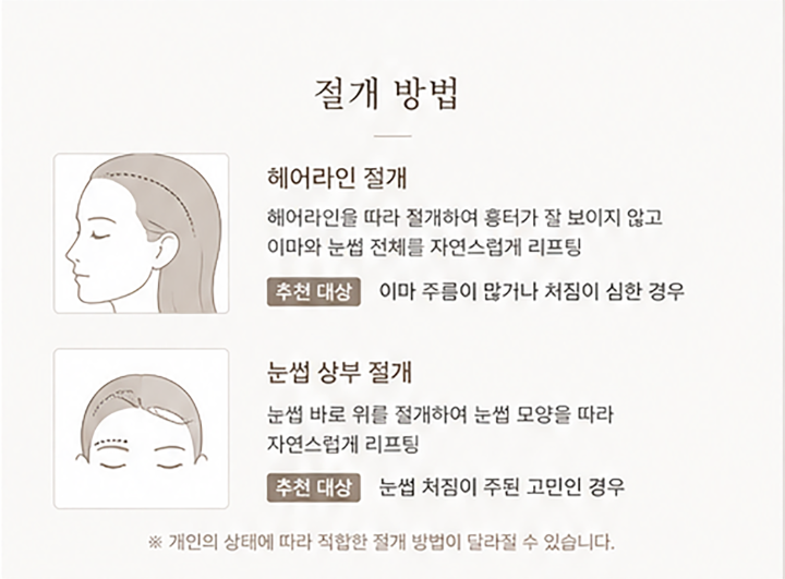 Droopy Eyebrow Thread Lift vs. Eyebrow Lift: Differences, Effects, and Recovery Period Explained 사진 9