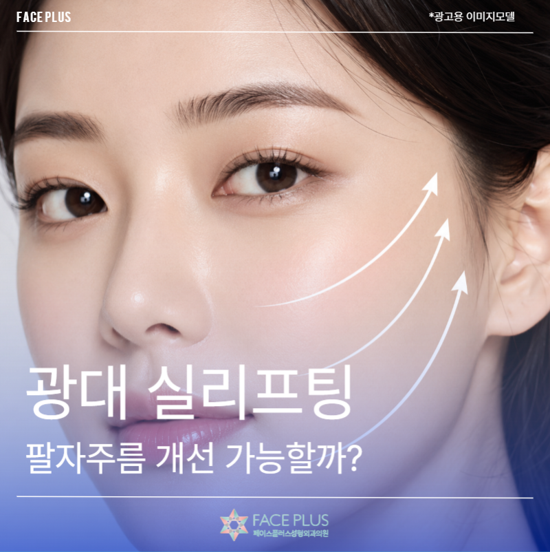 Can Cheekbone Thread Lift Improve Nasolabial Folds? Duration and Pain Explained