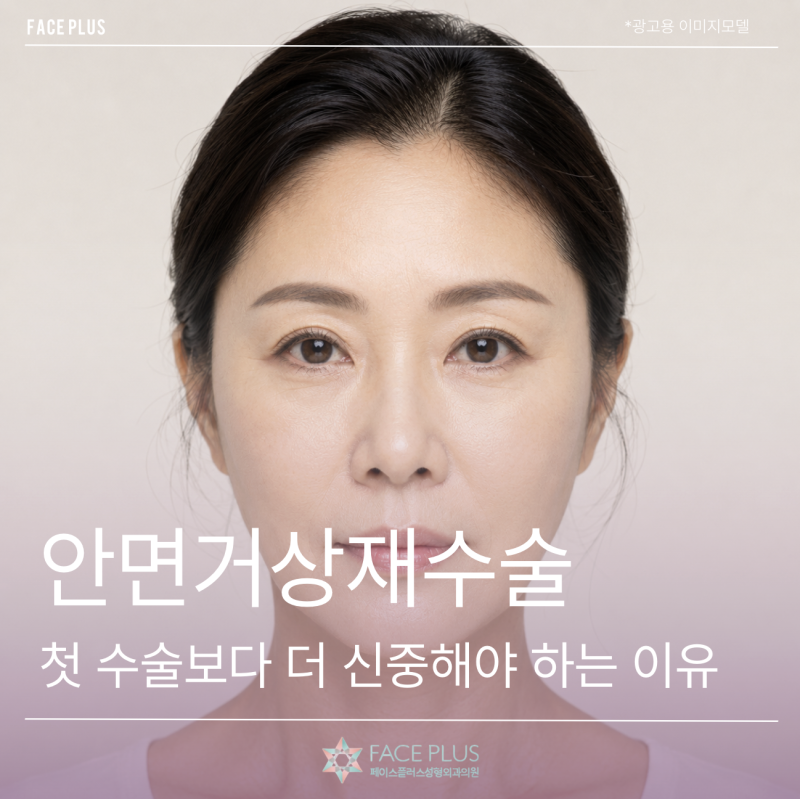 Facelift Revision Surgery: Why It Requires More Caution Than the First Surgery