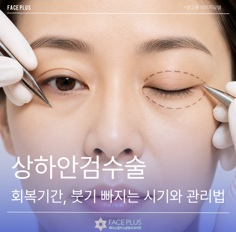 Upper and Lower Blepharoplasty Recovery Period: Swelling Timeline and Management Tips