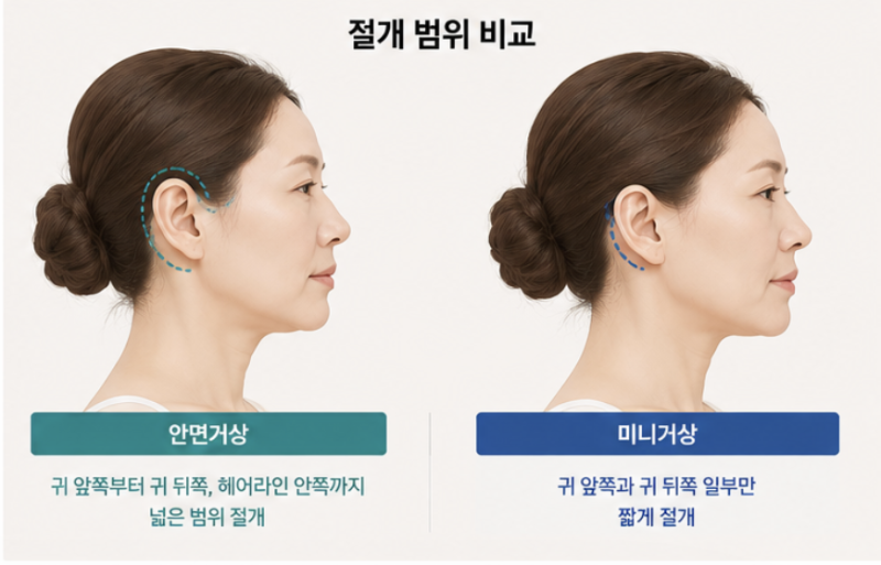 Facelift vs. Mini-Facelift: The Crucial Difference to Check Before Cost 사진 4