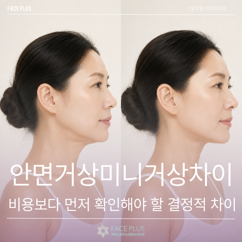 Facelift vs. Mini-Facelift: The Crucial Difference to Check Before Cost
