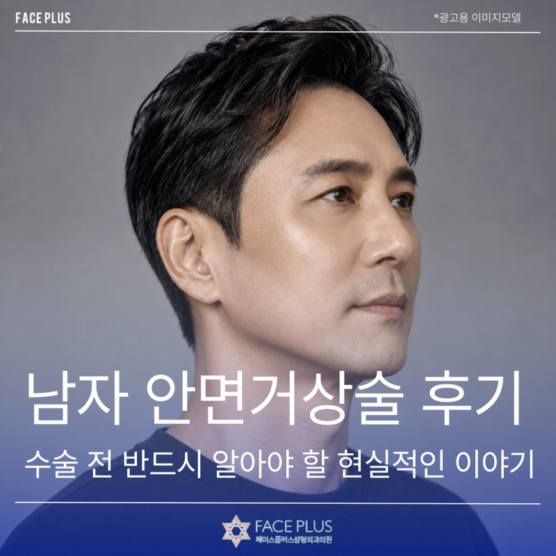 Men's Facelift Review: Realistic Insights You Must Know Before Surgery 사진 2