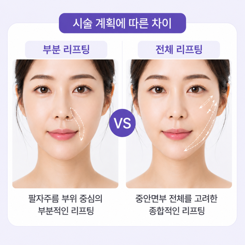 Nasolabial Fold Lifting Price: Why It Varies by More Than Double Between Clinics 사진 8