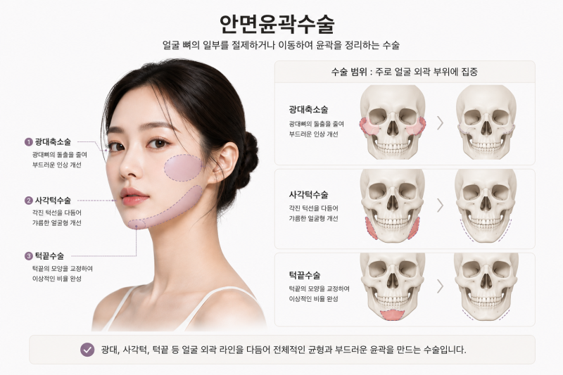 Facial Contouring Surgery vs. Double Jaw Surgery: What's the Difference in Recovery Time and Surgical Scope? 사진 5