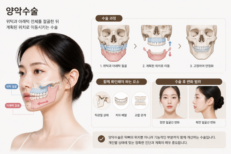 Facial Contouring Surgery vs. Double Jaw Surgery: What's the Difference in Recovery Time and Surgical Scope? 사진 6