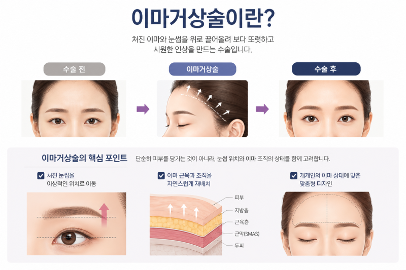 Forehead Lift for Twenties: Too Soon? Criteria More Important Than Age