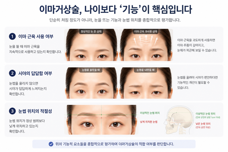 Forehead Lift for Twenties: Too Soon? Criteria More Important Than Age 사진 7