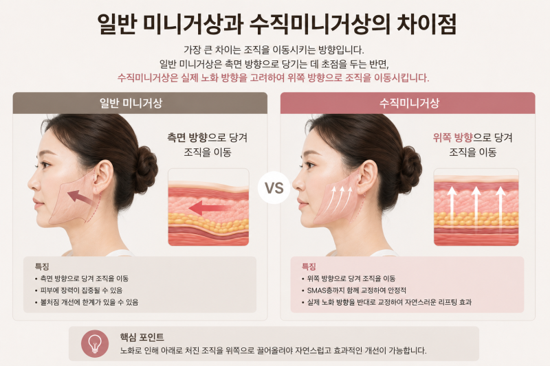 If Sagging Cheeks Bother You Every Time You Look in the Mirror, Let's Talk About Vertical Mini Facelift 사진 7