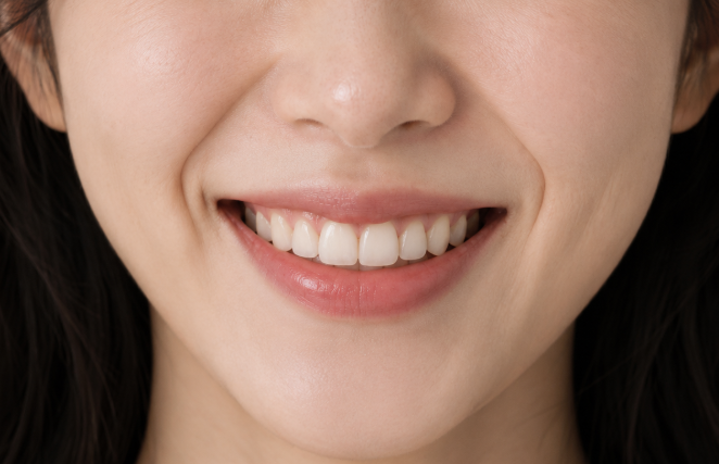 Nasolabial Fold Filler vs. Thread Lift: Why the Approach Differs for the Same Concern 사진 3