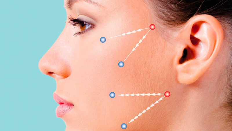 Silhouette Soft vs. Mint Thread vs. Jamber Thread: Choosing the Right Option for Your Face